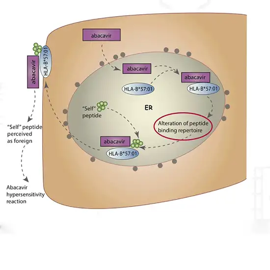 HLA Hypersensitivity Allopurinol